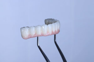 Dental implant supported full arch porcelain dental prosthesis for edentulous jaws in dentistry. Intraosseous dental implant and full arch dental prosthesis treatment. smile makeover.